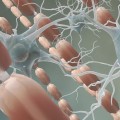 Is myelin sheath destroyed in multiple sclerosis?