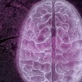 Unveiling Sclerosis: A Glimpse Into The Neurological Abyss