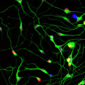 How does multiple sclerosis affect motor nerves?