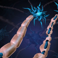 Is multiple sclerosis a problem with the myelin sheath?