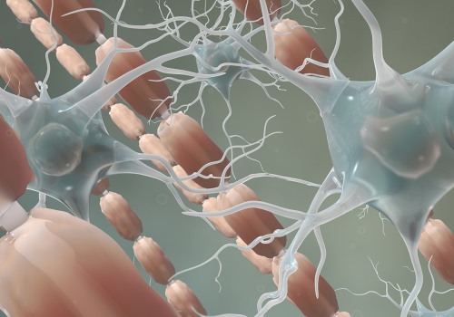 Is myelin sheath destroyed in multiple sclerosis?