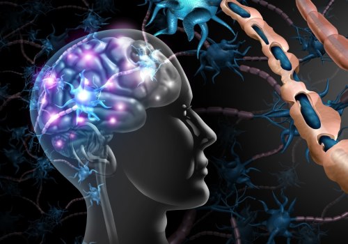 How does multiple sclerosis affect the conduction of an action potential?