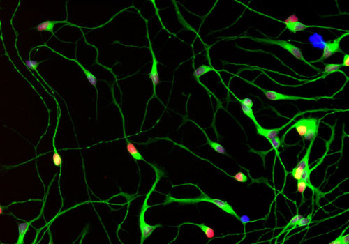 How does multiple sclerosis affect motor nerves?