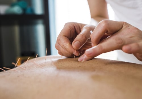 Acupuncture: An Alternative Treatment for MS Symptoms